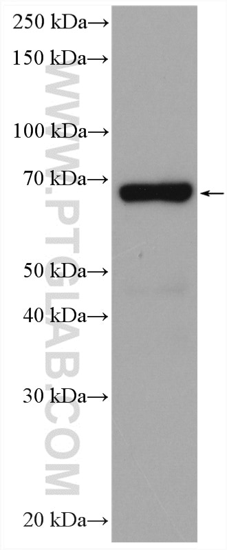 WB analysis of mouse placenta using 14642-1-AP