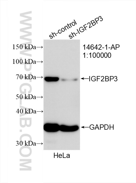 Western Blot (WB) analysis of HeLa cells using IGF2BP3 Polyclonal antibody (14642-1-AP)