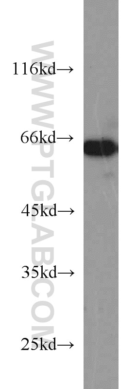 Western Blot (WB) analysis of BxPC-3 cells using IGF2BP3 Polyclonal antibody (14642-1-AP)