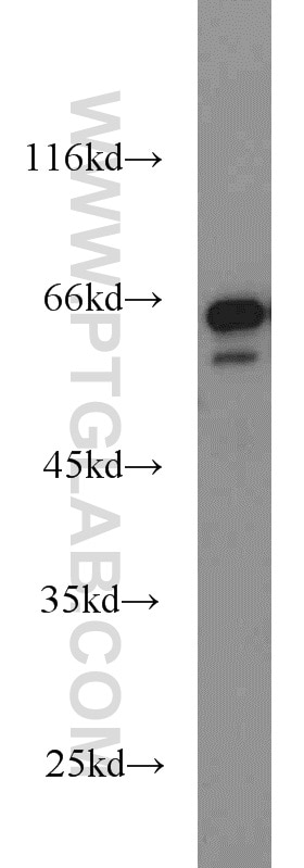 Western Blot (WB) analysis of HeLa cells using IGF2BP3 Polyclonal antibody (14642-1-AP)
