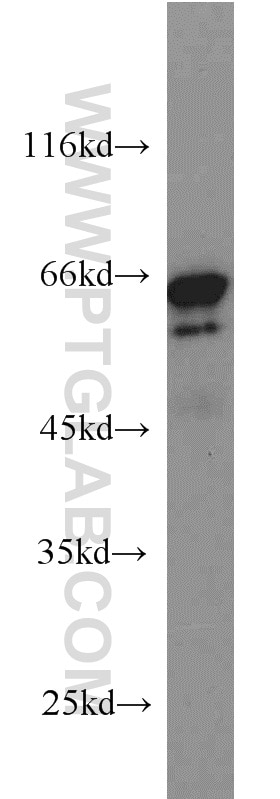 Western Blot (WB) analysis of HeLa cells using IGF2BP3 Polyclonal antibody (14642-1-AP)