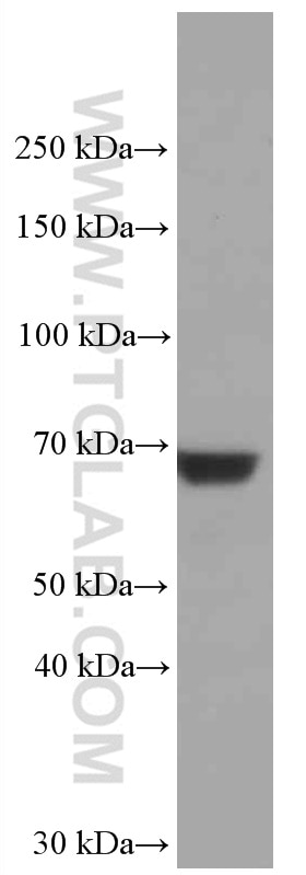 Western Blot (WB) analysis of HSC-T6 cells using IGF2BP3 Monoclonal antibody (66526-1-Ig)
