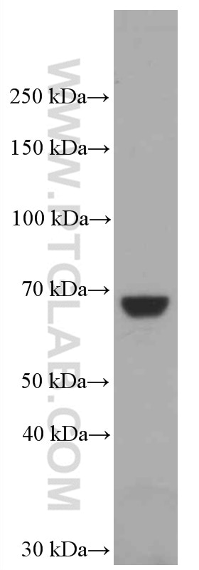 Western Blot (WB) analysis of NIH/3T3 cells using IGF2BP3 Monoclonal antibody (66526-1-Ig)
