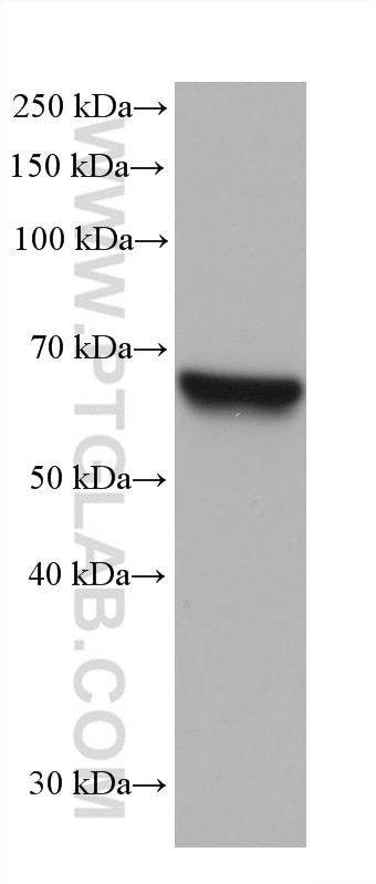 Western Blot (WB) analysis of A549 cells using IGF2BP3 Monoclonal antibody (68470-1-Ig)