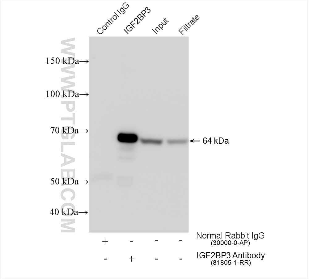 Immunoprecipitation (IP) experiment of HeLa cells using IGF2BP3 Recombinant antibody (81805-1-RR)