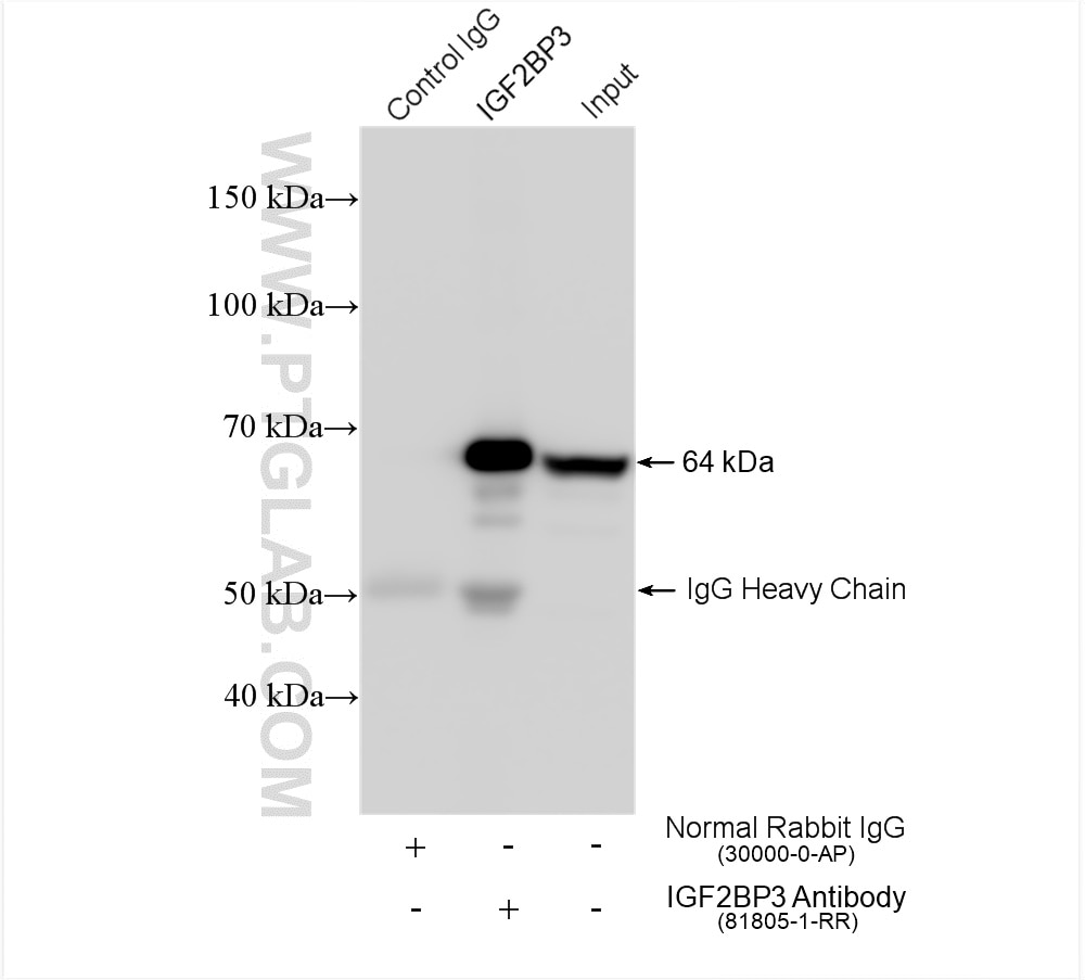 Immunoprecipitation (IP) experiment of HeLa cells using IGF2BP3 Recombinant antibody (81805-1-RR)