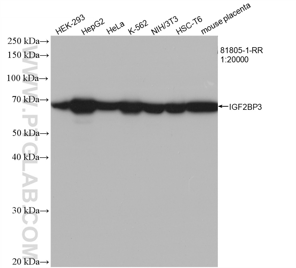 Western Blot (WB) analysis of various lysates using IGF2BP3 Recombinant antibody (81805-1-RR)