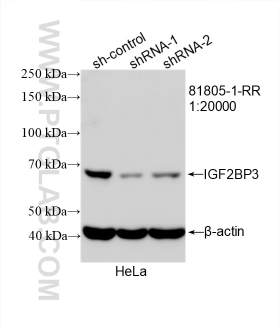 Western Blot (WB) analysis of HeLa cells using IGF2BP3 Recombinant antibody (81805-1-RR)