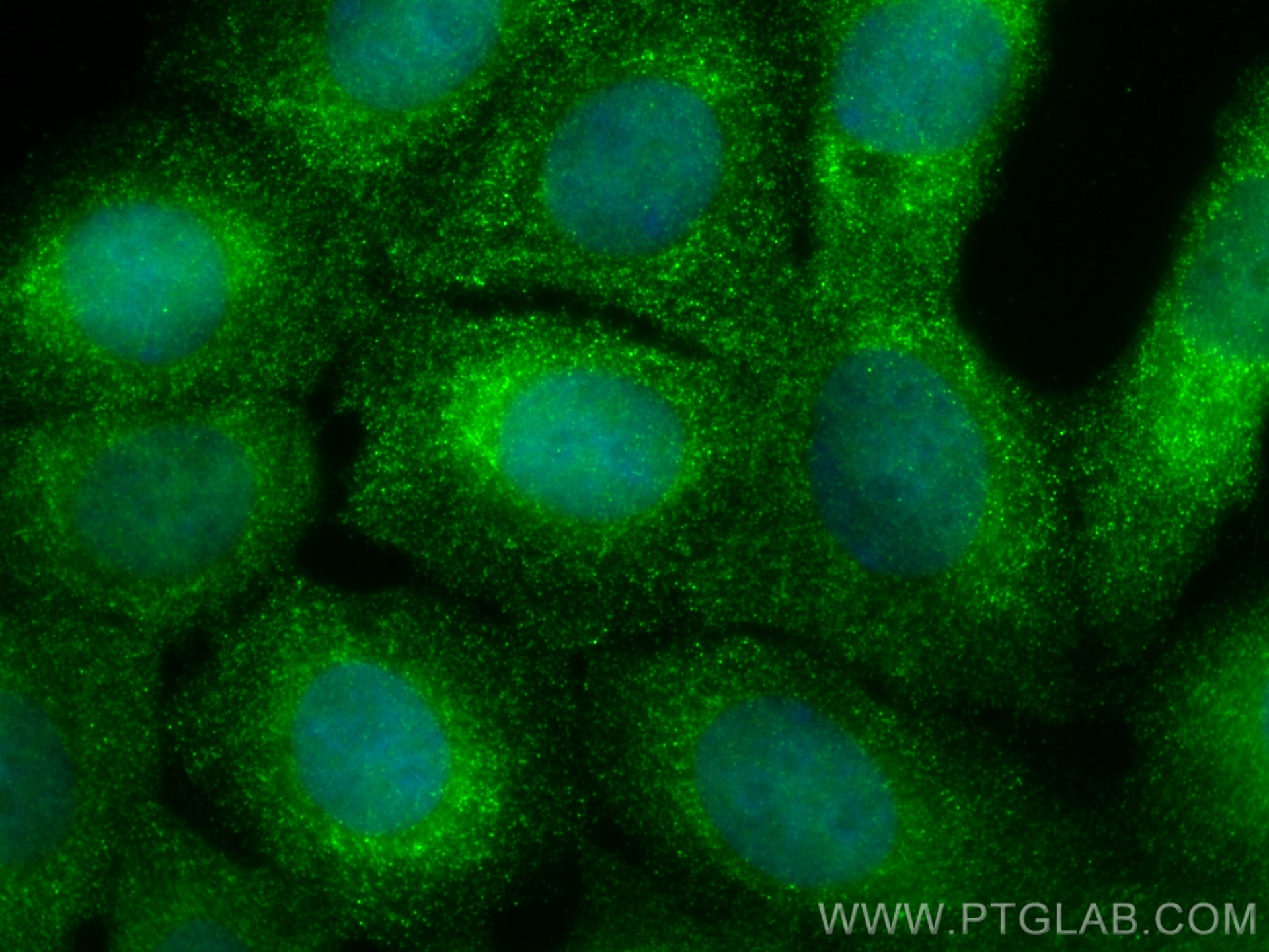 Immunofluorescence (IF) / fluorescent staining of MCF-7 cells using CoraLite® Plus 488-conjugated IGF2BP3 Monoclonal a (CL488-66526)