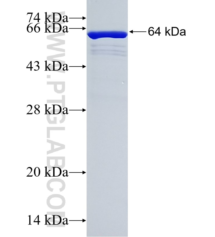 IGF2BP3 fusion protein Ag6226 SDS-PAGE