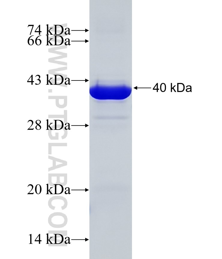 IGF2BP3 fusion protein Ag6349 SDS-PAGE