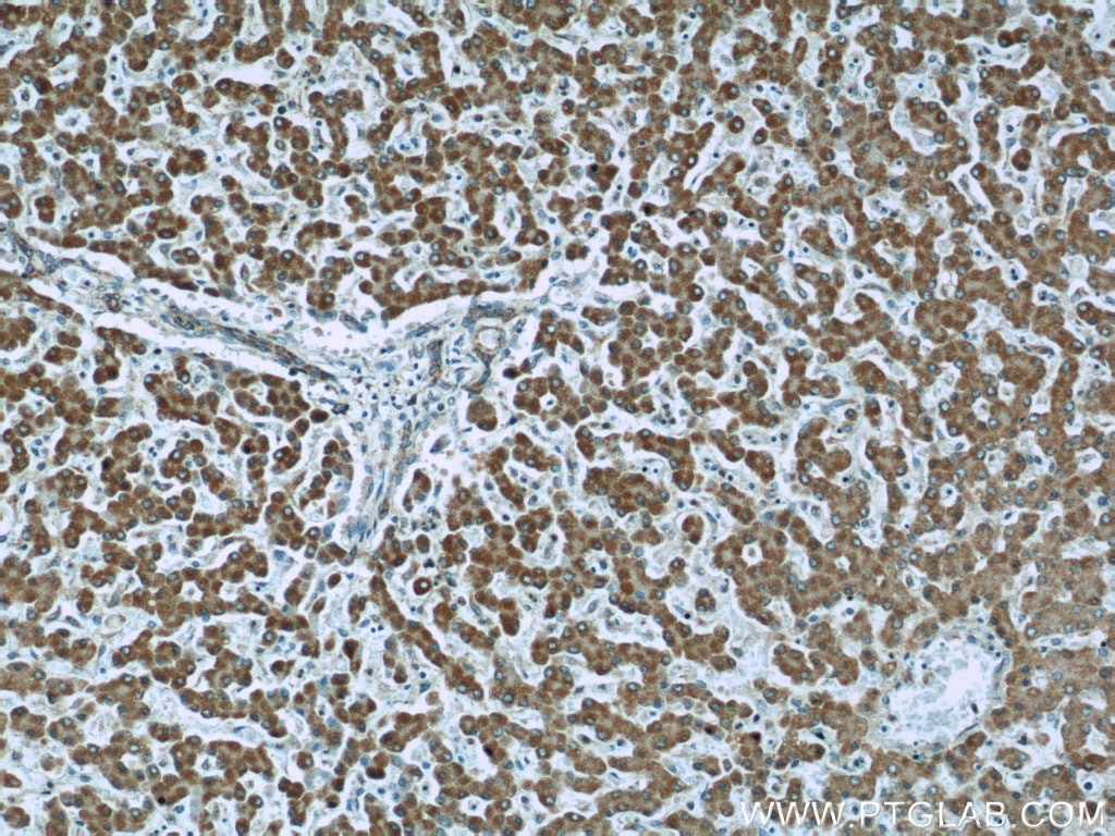 Immunohistochemistry (IHC) staining of human liver tissue using IGF2R-Specific Polyclonal antibody (20253-1-AP)