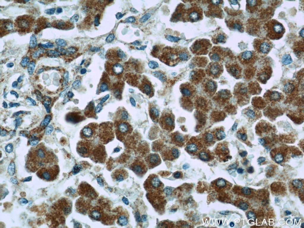 Immunohistochemistry (IHC) staining of human liver tissue using IGF2R-Specific Polyclonal antibody (20253-1-AP)