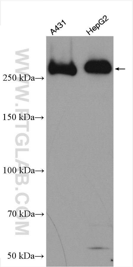 Western Blot (WB) analysis of various lysates using IGF2R-Specific Polyclonal antibody (20253-1-AP)