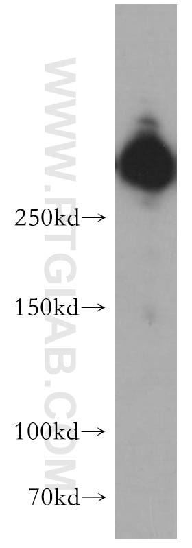 Western Blot (WB) analysis of HepG2 cells using IGF2R-Specific Polyclonal antibody (20253-1-AP)