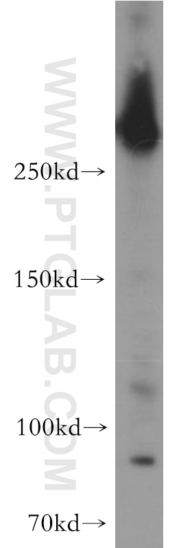 Western Blot (WB) analysis of A431 cells using IGF2R-Specific Polyclonal antibody (20253-1-AP)