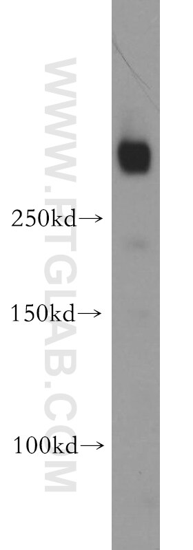 Western Blot (WB) analysis of L02 cells using IGF2R-Specific Polyclonal antibody (20253-1-AP)
