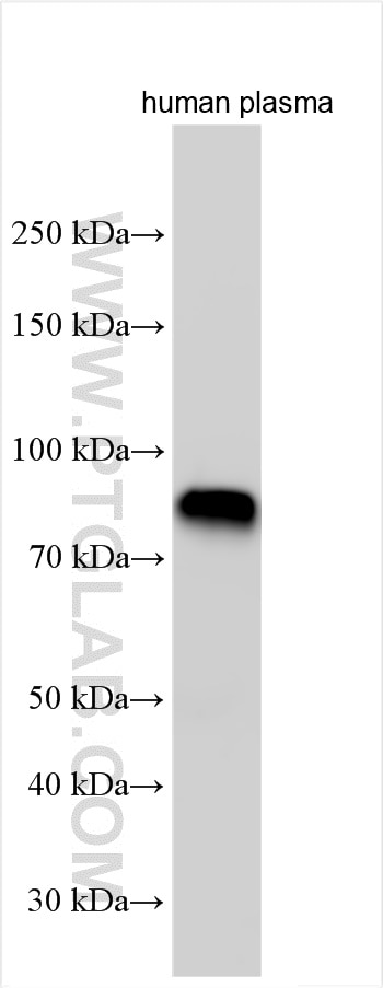 Western Blot (WB) analysis of human plasma using IGFALS Polyclonal antibody (24545-1-AP)