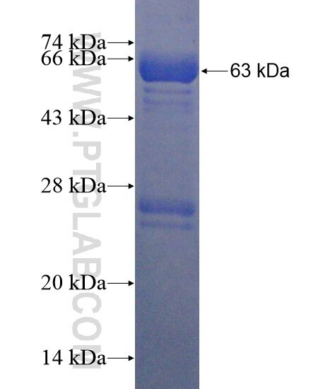 IGFALS fusion protein Ag21696 SDS-PAGE