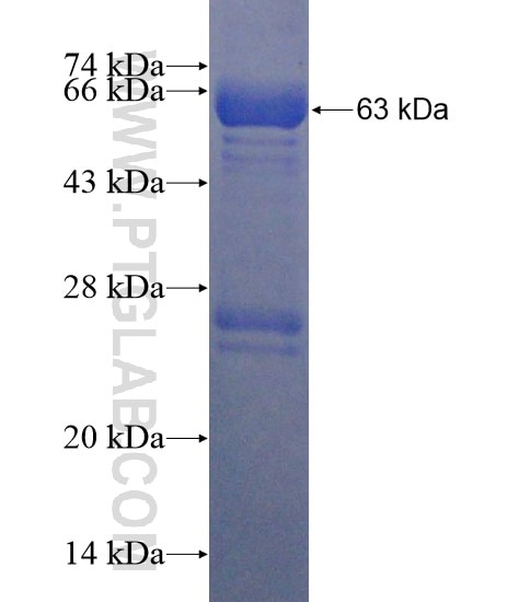 IGFALS fusion protein Ag21696 SDS-PAGE