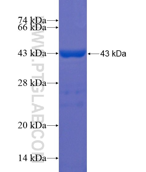 IGFALS fusion protein Ag21707 SDS-PAGE