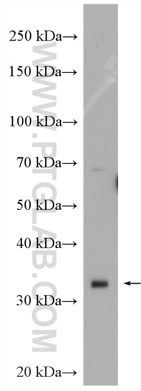 Western Blot (WB) analysis of human placenta tissue using IGFBP1 Polyclonal antibody (13981-1-AP)
