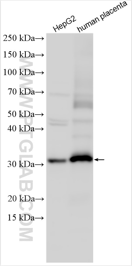 Western Blot (WB) analysis of various lysates using IGFBP1 Polyclonal antibody (13981-1-AP)
