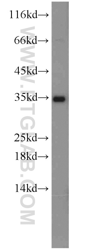 Western Blot (WB) analysis of human placenta tissue using IGFBP1 Polyclonal antibody (13981-1-AP)