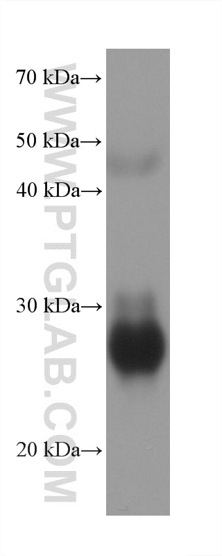 Western Blot (WB) analysis of human plasma using IGFBP1 Monoclonal antibody (60717-8-Ig)