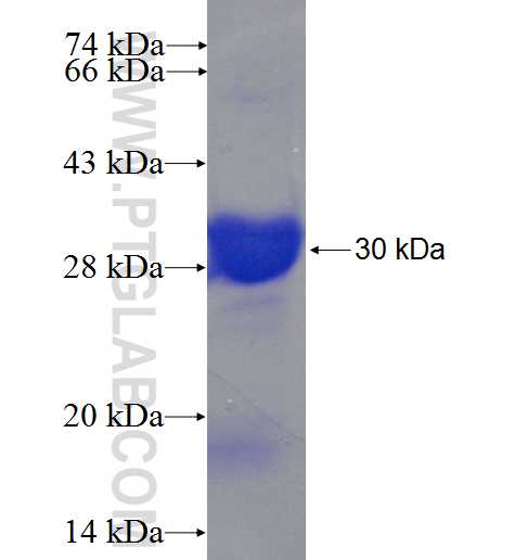 IGFBP1 fusion protein Ag5852 SDS-PAGE