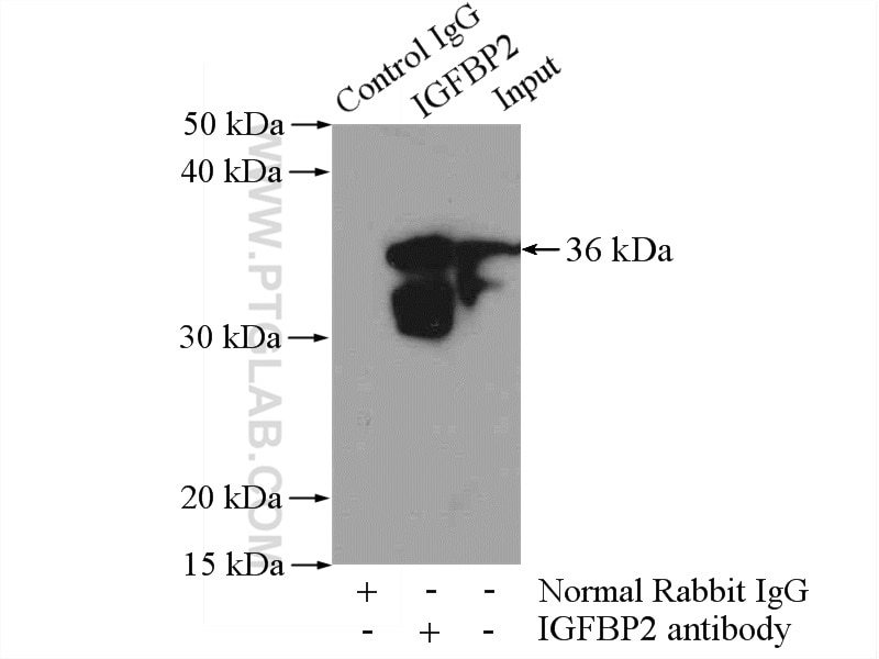 Immunoprecipitation (IP) experiment of SH-SY5Y cells using IGFBP2 Polyclonal antibody (11065-3-AP)