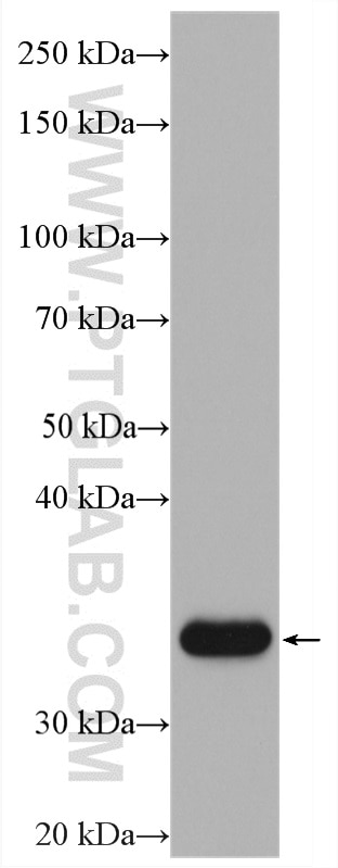 Western Blot (WB) analysis of SH-SY5Y cells using IGFBP2 Polyclonal antibody (11065-3-AP)