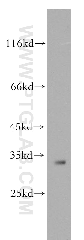 IGFBP2 Polyclonal antibody
