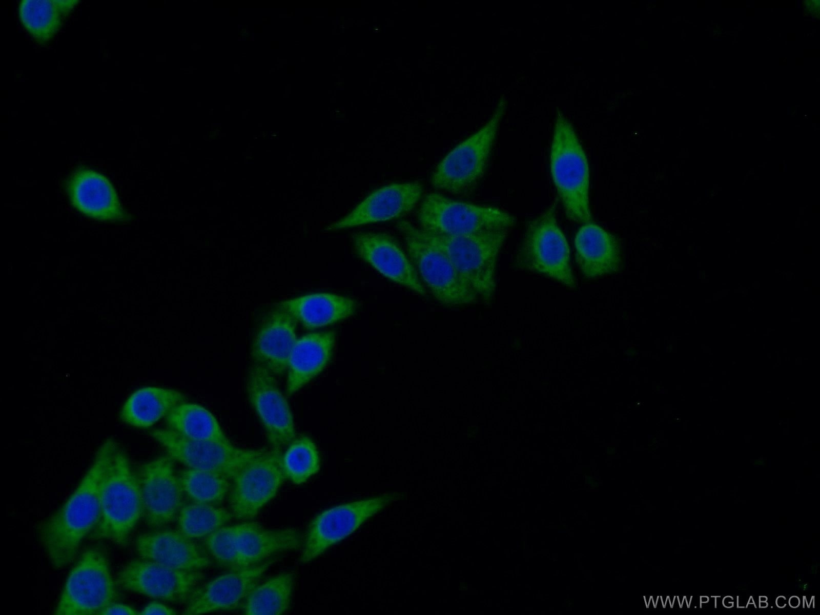 Immunofluorescence (IF) / fluorescent staining of HeLa cells using IGFBP2 Polyclonal antibody (15699-1-AP)