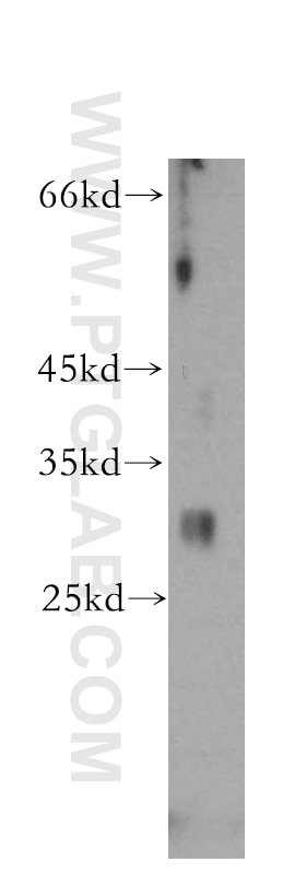 Western Blot (WB) analysis of PC-3 cells using IGFBP2 Polyclonal antibody (15699-1-AP)