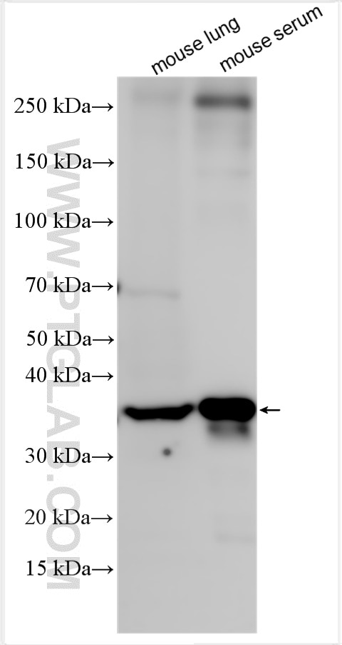 Western Blot (WB) analysis of various lysates using IGFBP2 Polyclonal antibody (32052-1-AP)