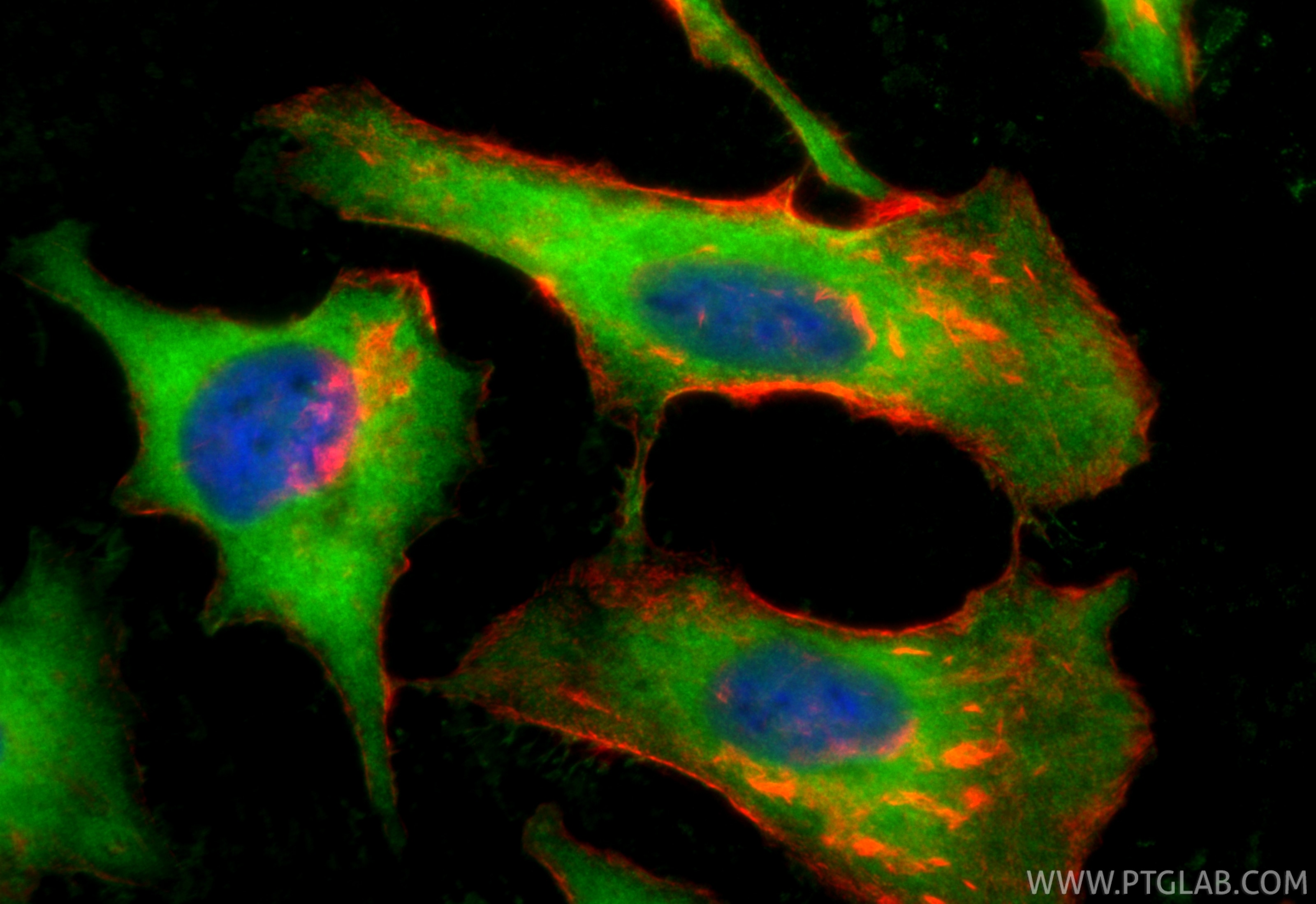 Immunofluorescence (IF) / fluorescent staining of HeLa cells using CoraLite® Plus 488-conjugated IGFBP2 Recombinant m (CL488-84092-3)