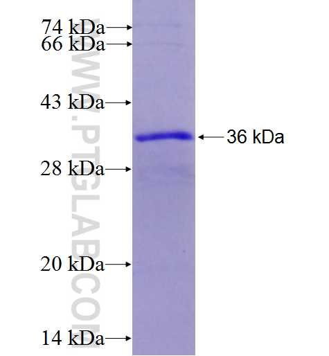 IGFBP2 fusion protein Ag8421 SDS-PAGE