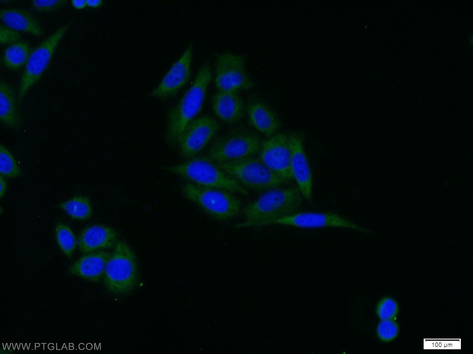 Immunofluorescence (IF) / fluorescent staining of HeLa cells using IGFBP3 Polyclonal antibody (10189-2-AP)