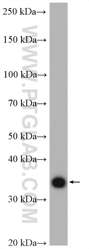 WB analysis of mouse colon using 10189-2-AP