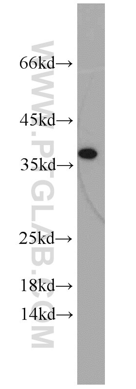 Western Blot (WB) analysis of A2780 cells using IGFBP3 Polyclonal antibody (10189-2-AP)