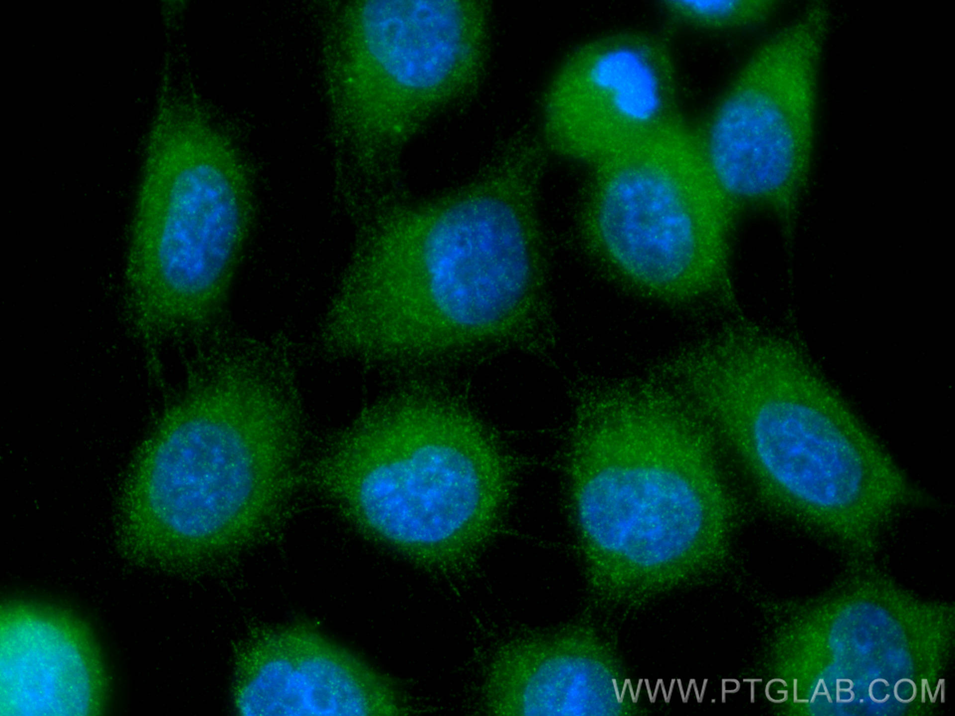 Immunofluorescence (IF) / fluorescent staining of A431 cells using IGFBP3 Polyclonal antibody (30593-1-AP)