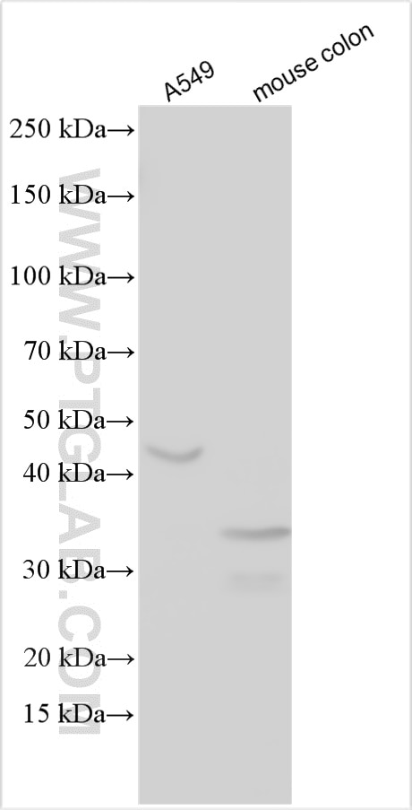 Western Blot (WB) analysis of various lysates using IGFBP3 Polyclonal antibody (30593-1-AP)