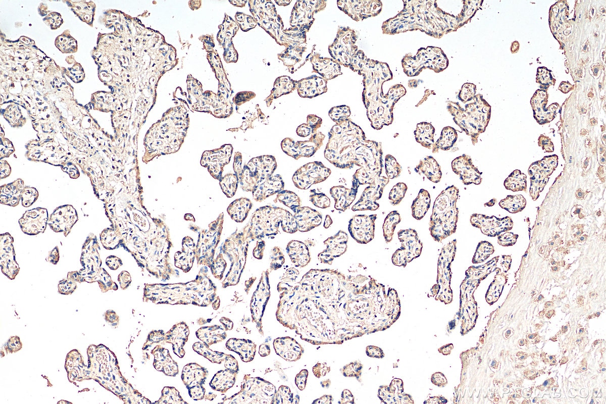 Immunohistochemistry (IHC) staining of human placenta tissue using IGFBP3 Monoclonal antibody (68402-1-Ig)