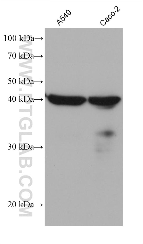 Western Blot (WB) analysis of various lysates using IGFBP3 Monoclonal antibody (68402-1-Ig)