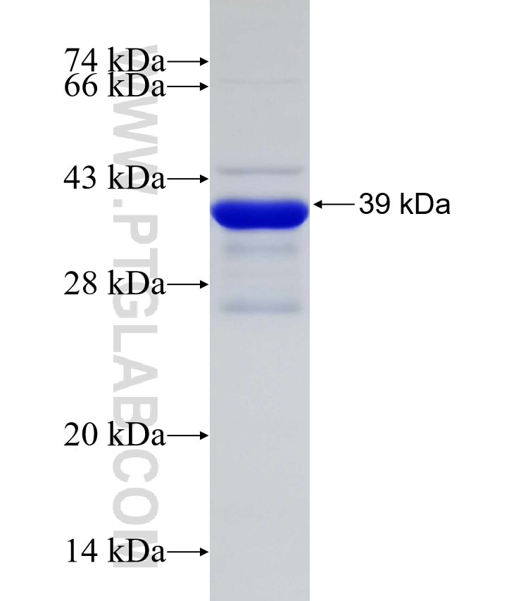 IGFBP3 fusion protein Ag31285 SDS-PAGE IGFBP3 fusion protein Ag31285 SDS-PAGE