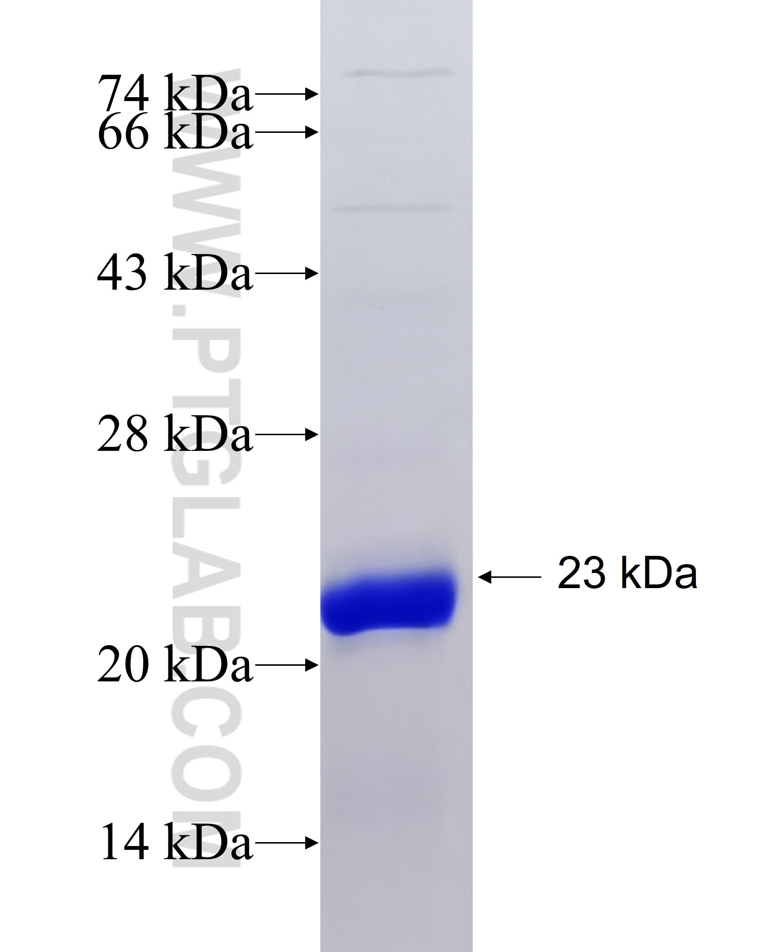 IGFBP3 fusion protein Ag31296 SDS-PAGE