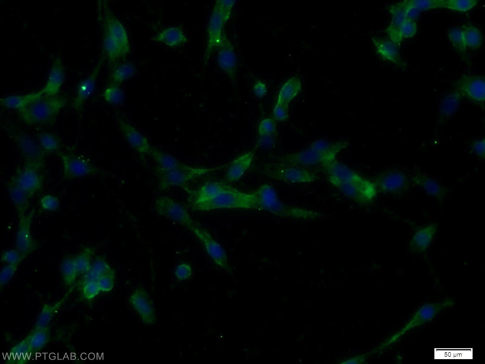 Immunofluorescence (IF) / fluorescent staining of C6 cells using IGFBP4 Polyclonal antibody (18500-1-AP)