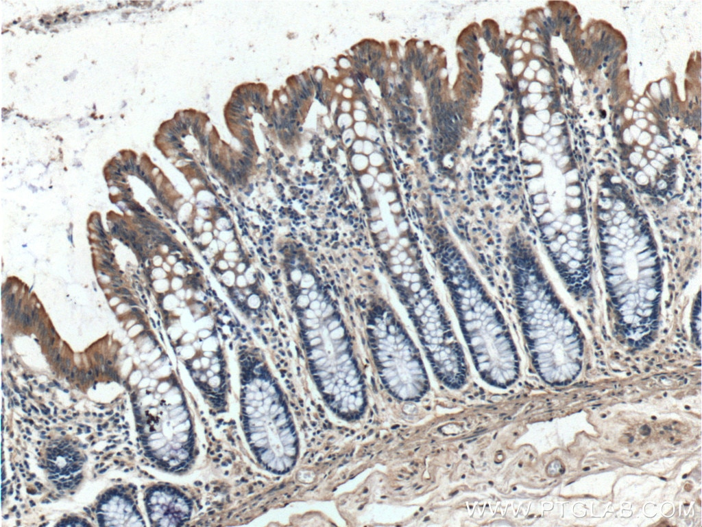 Immunohistochemistry (IHC) staining of human colon tissue using IGFBP4 Polyclonal antibody (18500-1-AP)