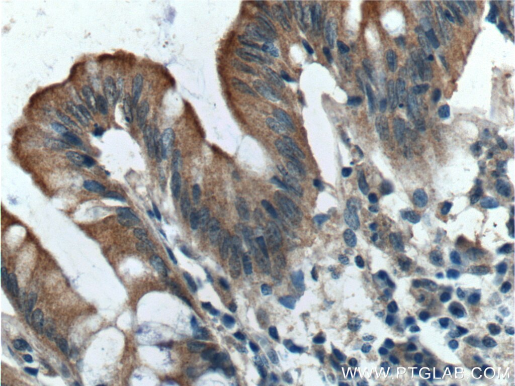 Immunohistochemistry (IHC) staining of human colon tissue using IGFBP4 Polyclonal antibody (18500-1-AP)